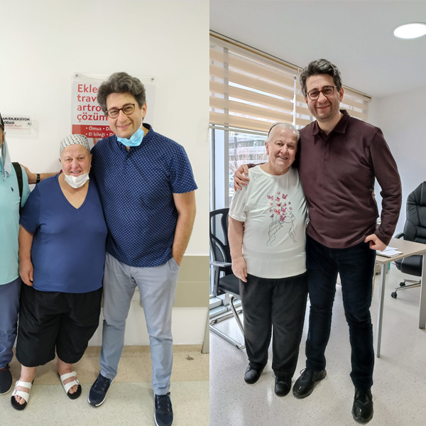 before after photos 1