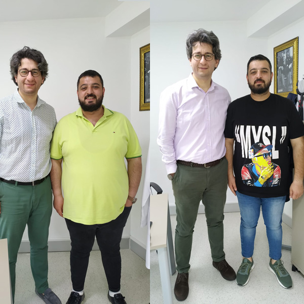 before after photos 3