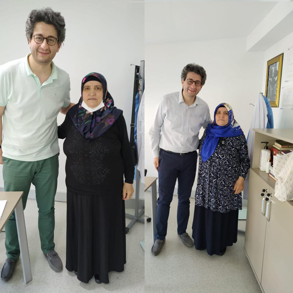 before after photos 4