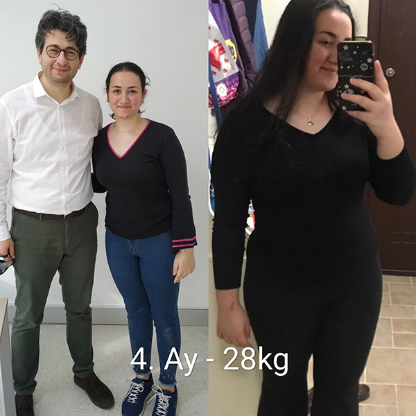 before after photos 5